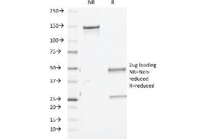 TGF-beta antibody