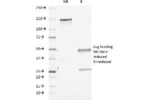 SDS-PAGE Analysis Purified TGF beta Mouse Monoclonal Antibody (TGFB/510). (TGF-beta antibody)