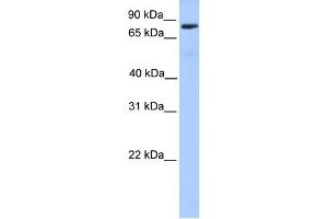 WB Suggested Anti-C12orf40 Antibody Titration: 0. (C12orf40 antibody  (N-Term))