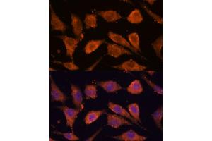 Immunofluorescence analysis of L929 cells using RHBDF1 antibody (ABIN7269977) at dilution of 1:100. (RHBDF1 antibody  (AA 200-400))