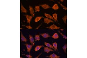 Immunofluorescence analysis of L929 cells using RHBDF1 antibody (ABIN7269977) at dilution of 1:100. (RHBDF1 antibody  (AA 200-400))