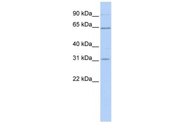 SLC27A2 anticorps  (N-Term)