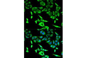 Immunofluorescence analysis of U2OS cells using HADHA antibody (ABIN5973083). (HADHA antibody)