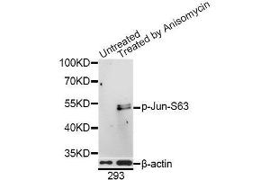 Western blot analysis of extracts of 293 cells, using Phospho-Jun-S63 antibody (ABIN5969905) at 1/1000 dilution.