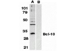 Western Blotting (WB) image for anti-B-Cell CLL/lymphoma 10 (BCL10) (N-Term) antibody (ABIN1031265) (BCL10 antibody  (N-Term))