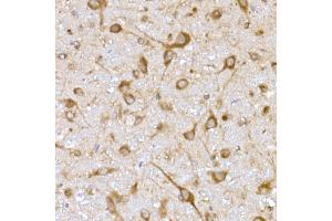 Immunohistochemistry of paraffin-embedded rat brain using USO1 Rabbit mAb (ABIN7271234) at dilution of 1:25 (40x lens). (USO1 antibody)