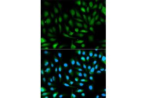 Immunofluorescence analysis of HeLa cells using PARK7 antibody. (PARK7/DJ1 antibody)