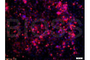 Formalin-fixed and paraffin embedded: human lung epithelial cells labeled with Anti-Glucocorticoid receptor(GR) Polyclonal Antibody, Unconjugated (ABIN726875) at 1:200,, followed by conjugation to the secondary antibody was Goat Anti-Rabbit IgG, PE conjugated at 1:200 for 40 minutes at 37°C (Glucocorticoid Receptor antibody  (AA 231-320))