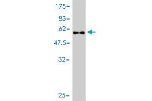 Western Blotting (WB) image for anti-Protein Kinase, AMP-Activated, beta 2 Non-Catalytic Subunit (PRKAB2) (AA 1-272) antibody (ABIN562365)