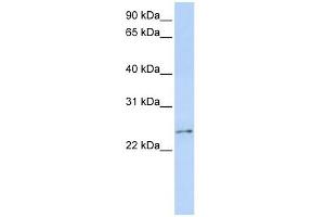 RCAN3 antibody used at 1 ug/ml to detect target protein. (RCAN3 antibody  (Middle Region))