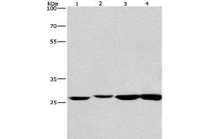 Western Blot analysis of Humna colon cancer and Mouse kidney tissue, Mouse testis and Human fetal brain tissue using KLF7 Polyclonal Antibody at dilution of 1:483. (KLF7 antibody)