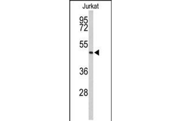 Achaete-scute complex protein T5 (AC) (AA 387-416), (C-Term) antibody