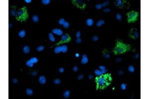 Anti-ACSM5 mouse monoclonal antibody (ABIN2455647) immunofluorescent staining of COS7 cells transiently transfected by pCMV6-ENTRY ACSM5 (RC209798). (ACSM5 antibody)