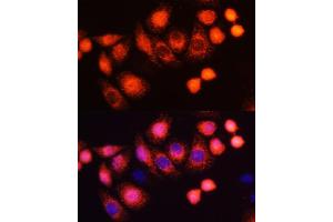 Immunofluorescence analysis of HeLa cells using HRAS antibody (ABIN6130448, ABIN6141983, ABIN6141985 and ABIN6215813) at dilution of 1:100 (40x lens).