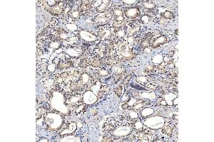 IHC analysis of Syntenin 2/SDCBP2 using anti-Syntenin 2/SDCBP2 antibody (ABIN7600017). (SDCBP2 antibody  (AA 14-292))