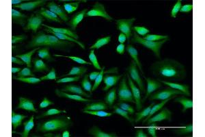 Immunofluorescence of purified MaxPab antibody to IFIT2 on HeLa cell.