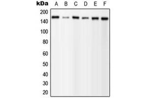 Western blot analysis of PLC gamma 1 (pY1253) expression in MCF7 EGF-treated (A), A431 (B), mouse brain (C), mouse liver (D), H9C2 EGF-treated (E) whole cell lysates.
