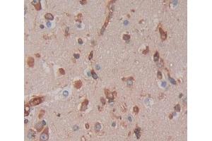 IHC-P analysis of brain tissue, with DAB staining. (GTF3A antibody  (AA 71-365))