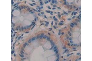 Figure. (ETFA antibody  (AA 52-295))