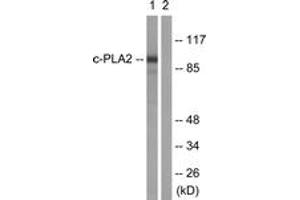 Western blot analysis of extracts from HeLa cells, treated with TNF-a 20ng/ml 30', using c-PLA2 (Ab-505) Antibody. (C-PLA2 (AA 471-520) antibody)