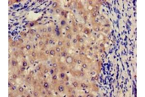Immunohistochemistry of paraffin-embedded human liver tissue using ABIN7172206 at dilution of 1:100