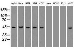 Image no. 3 for anti-Keratin 18 (KRT18) (AA 69-372) antibody (ABIN1491638) (Cytokeratin 18 antibody  (AA 69-372))