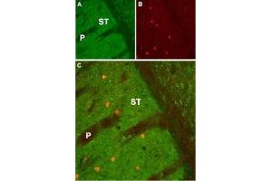 Expression of Muscarinic acetylcholine receptor M1 in mouse striatum - Immunohistochemical staining of mouse striatum (ST) using Anti-CHRM1 Antibody (ABIN7043060, ABIN7044580 and ABIN7044581). (CHRM1 antibody  (AA 227-353))