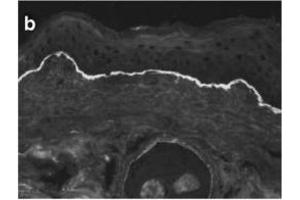 Immunofluorescence image of Collagen VII staining in cryosections of murine Skin. (Collagen Type VII NC1 FN-III-Like Domains 7 and 8 (AA 757-967) antibody)