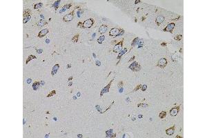 Immunohistochemistry of paraffin-embedded Rat brain using VEGFC Polyclonal Antibody (VEGFC antibody)