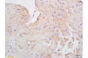 Formalin-fixed and paraffin embedded mouse heart labeled with Rabbit Anti Ninein/GSK3B interacting protein Polyclonal Antibody, Unconjugated (ABIN872552) at 1:200 followed by conjugation to the secondary antibody and DAB staining