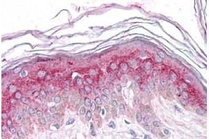 Human Skin: Formalin-Fixed, Paraffin-Embedded (FFPE) (GM2A antibody  (N-Term))
