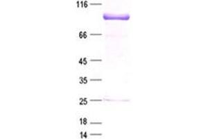 Validation with Western Blot (SOX5 Protein (DYKDDDDK Tag))
