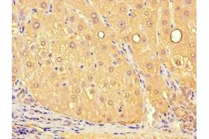 Immunohistochemistry of paraffin-embedded human liver tissue using ABIN7159849 at dilution of 1:100 (Slc25a1 antibody  (AA 124-162))