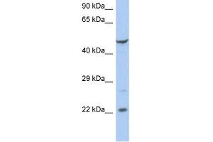 WB Suggested Anti-FLJ44894 Antibody Titration:  0.