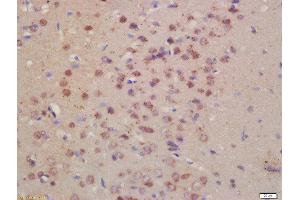 Formalin-fixed and paraffin embedded rat brain labeled with Rabbit Anti- Pro-Neuregulin Polyclonal Antibody, Unconjugated  at 1:200 followed by conjugation to the secondary antibody and DAB staining (Neuregulin 1 antibody  (AA 221-320))