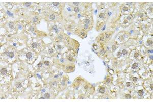 Immunohistochemistry (Paraffin-embedded Sections) (IHC (p)) image for anti-Proteasome Subunit alpha  7 (PSMA7) antibody (ABIN7260948)