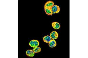 Confocal immunofluorescent analysis of AKT1 Antibody (N-term) (ABIN391212 and ABIN2841290) with MDA-M cell followed by Alexa Fluor 488-conjugated goat anti-rabbit lgG (green). (AKT1 antibody  (N-Term))