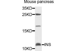 Western blot analysis of extracts of mouse pancreas cells, using INS antibody. (Insulin antibody)