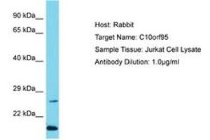 Image no. 1 for anti-Chromosome 10 Open Reading Frame 95 (C10ORF95) (N-Term) antibody (ABIN6750685) (C10ORF95 antibody  (N-Term))