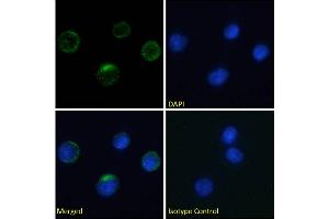 Immunofluorescence staining of fixed human peripheral blood monocytes (PBMs) with anti-Integrin beta-7 antibody FIB27. (Recombinant Integrin beta 7 antibody)