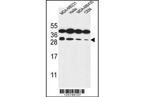 Western blot analysis of Syntaxin 10 / STX10 Antibody (N-term) in MDA-MB231, Hela, MDA-MB435, CEM cell line lysates (35ug/lane). (Syntaxin 10 antibody  (N-Term))
