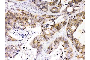 IHC analysis of NDRG3 using anti- NDRG3 antibody .