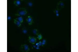 Anti-AK3 mouse monoclonal antibody (ABIN2452718) immunofluorescent staining of COS7 cells transiently transfected by pCMV6-ENTRY AK3 (RC204408). (Adenylate Kinase 3 antibody)