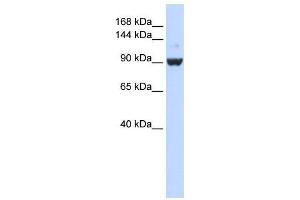 DHX34 antibody used at 1 ug/ml to detect target protein. (DHX34 antibody)