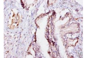 Immunohistochemistry of paraffin-embedded human prostate tissue using ABIN7152198 at dilution of 1:10 (eIF4EBP2 antibody  (AA 1-120))