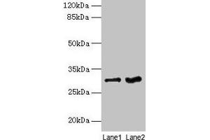 Western blot All lanes: FGFR1OP2 antibody at 6 μg/mL Lane 1: Mouse gonadal tissue Lane 2: Human placenta tissue Secondary Goat polyclonal to rabbit IgG at 1/10000 dilution Predicted band size: 30, 25, 21 kDa Observed band size: 30 kDa (FGFR1OP2 antibody  (AA 1-172))