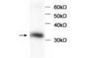 Image no. 1 for anti-Hemoglobin beta (HBB) antibody (ABIN791524) (Hemoglobin Subunit beta antibody)