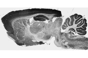 Adult rat whole brain immunohistochemistry. (KCNT2 antibody  (AA 564-624))