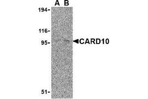Western blot analysis of CARD10 expression in EL4 cell lysate with AP30183PU-N CARD10 antibody at (A) 5 and (B) 10 μg /ml. (CARD10 antibody)