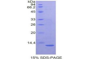 SDS-PAGE analysis of Mouse CTNNbIP1 Protein.